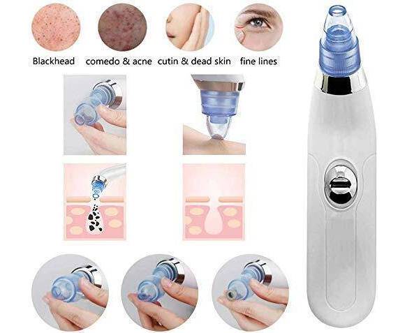 Blackhead Removal Machine-derma Suction 4 In 1 Black Head Remover Machine-acne Pimple Pore Cleaner Vacuum Suction Tool