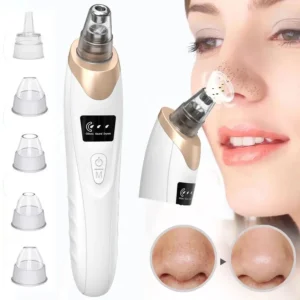 Electric Blackhead Remover | Vacuum Acne & Pore Cleaner | 5 Heads Suction Machine | Skin Care & Exfoliating Tool